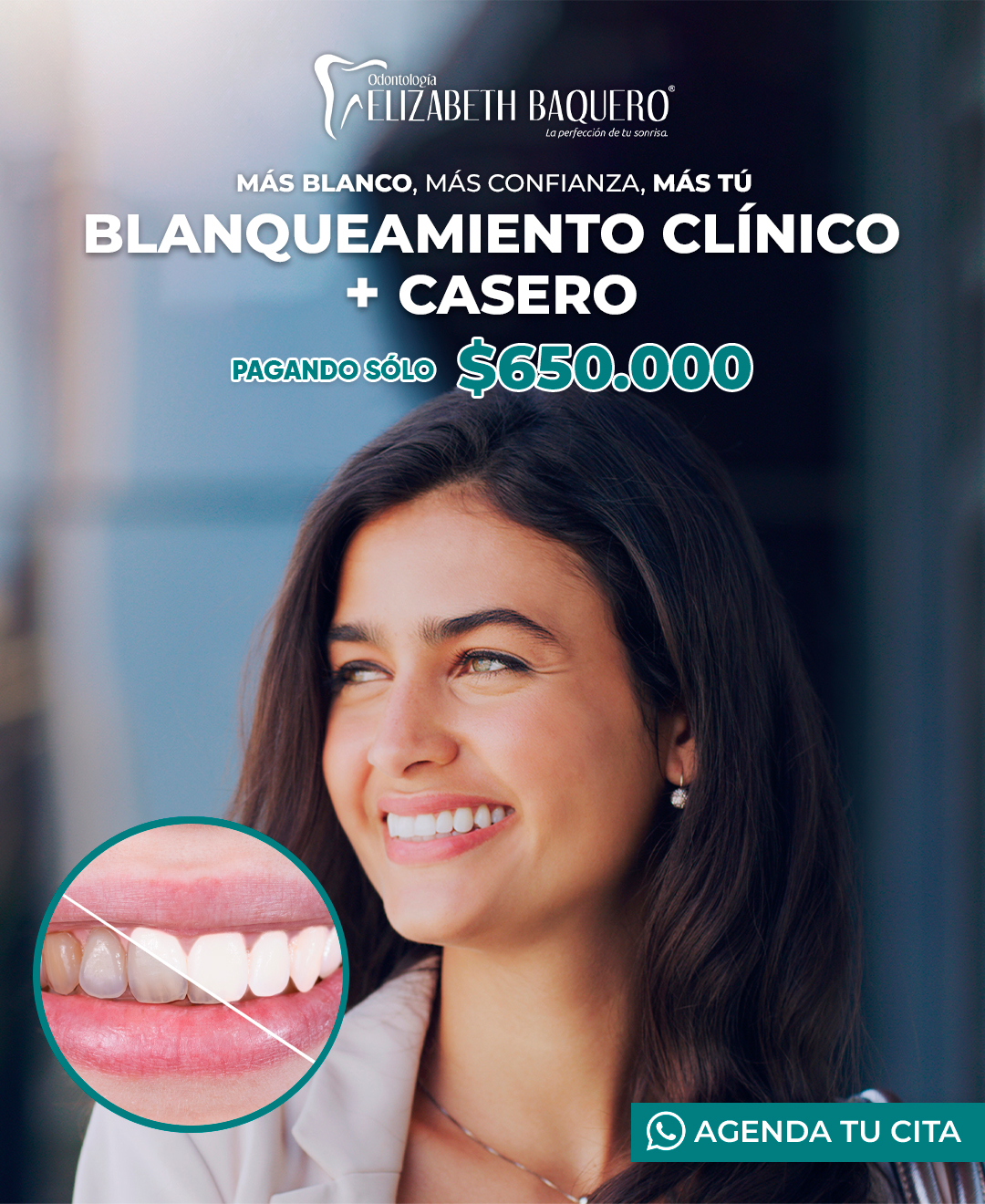 Promoción de blanqueamiento clínico más casero por 650.000 pesos