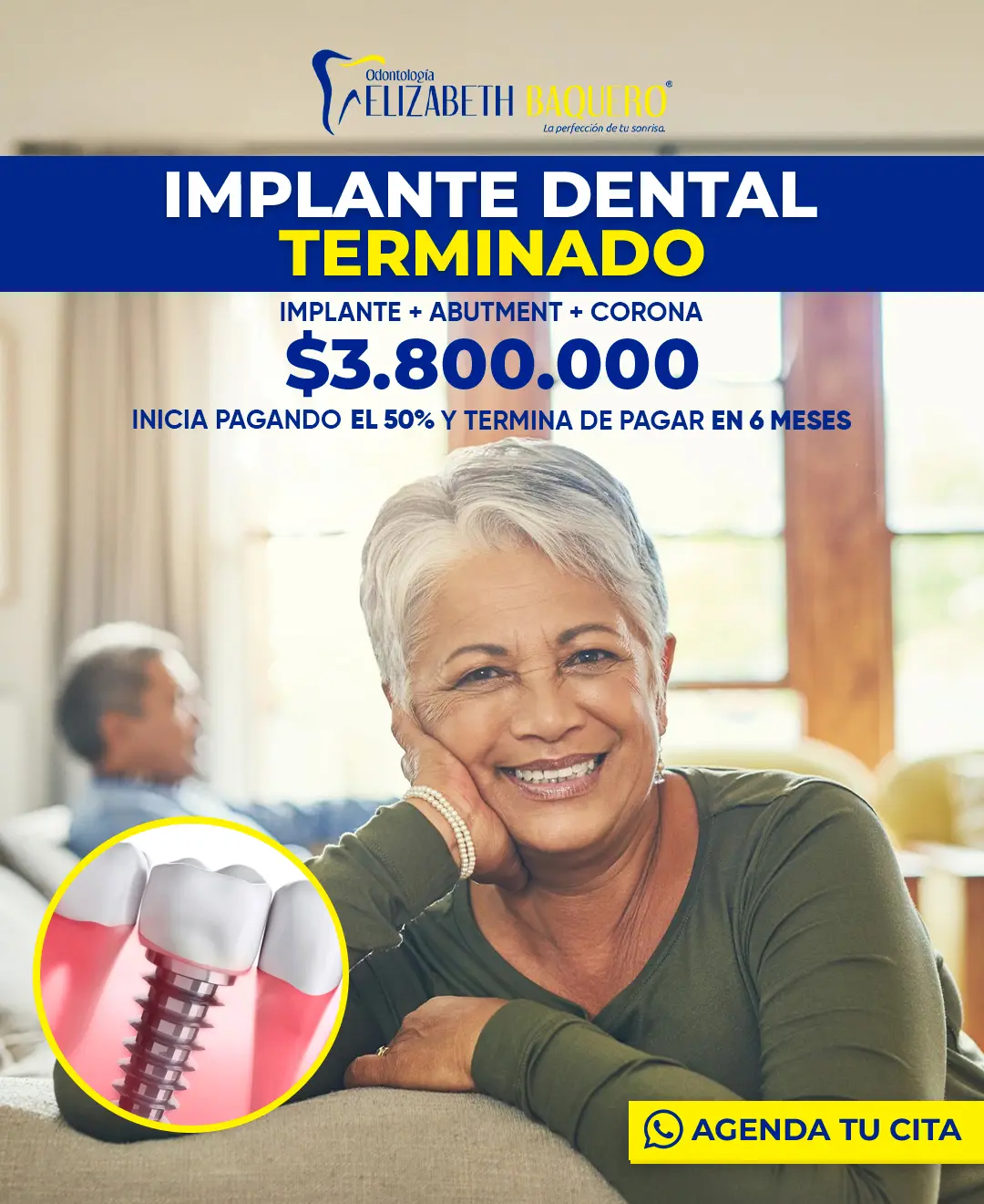 Resultado de implante dental terminado - Dra. Baquero