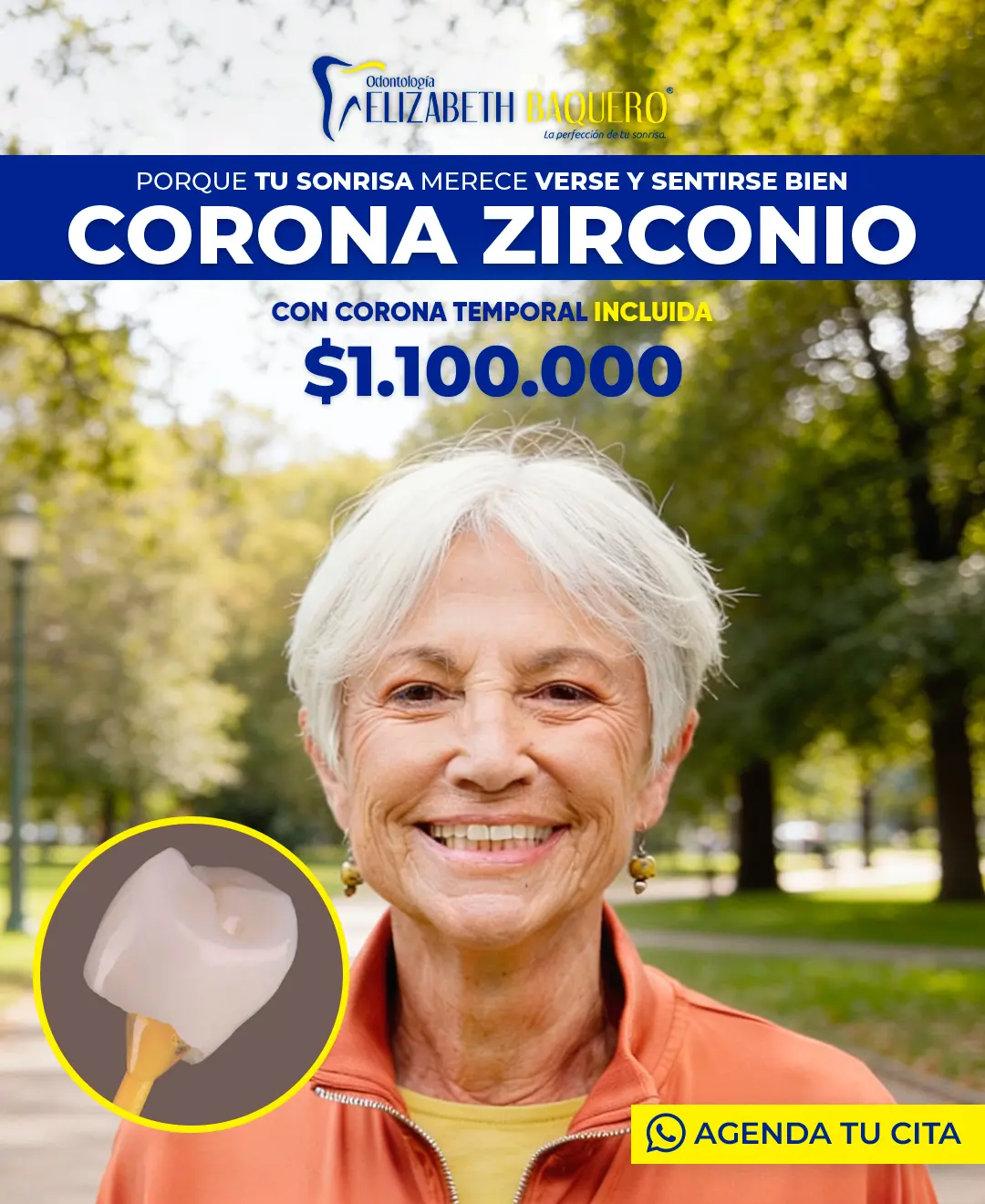 Resultado de corona de zirconio - Dra. Baquero