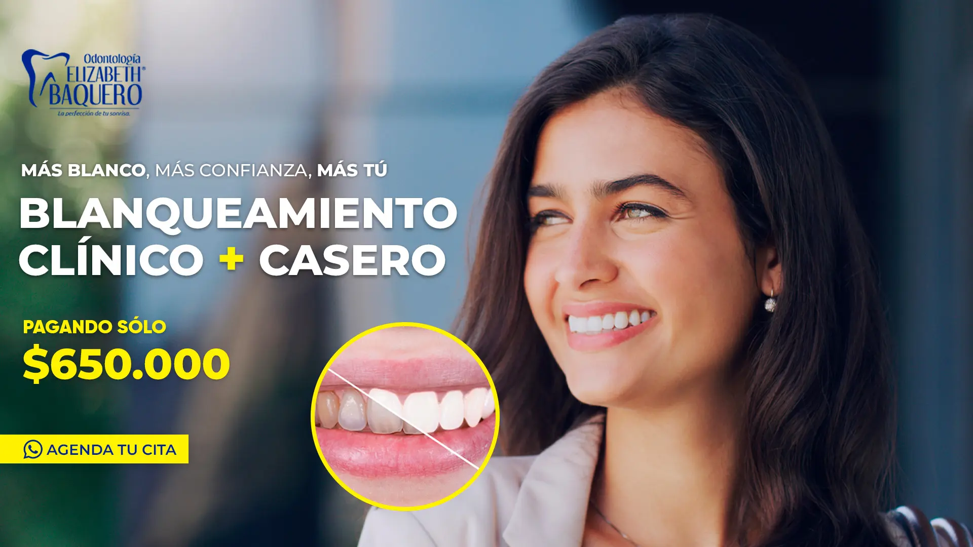 Promoción implante dental